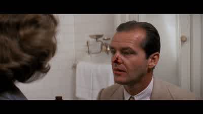 It's a nasty cut. - Chinatown