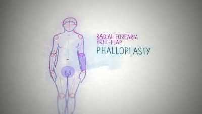 It's a very complex procedure - Naked Education