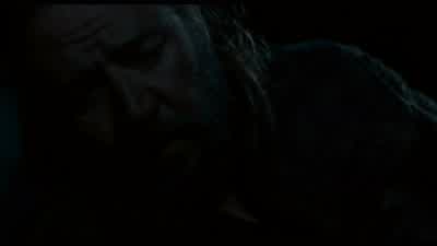 NAAMEH: It's an ugly wound. - Noah