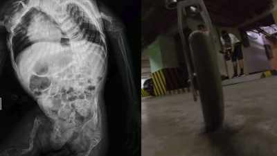 It's caused by
a single mutation - Q: Into the Storm