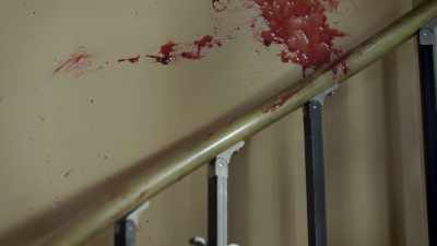 It's discovered that
she has blood on the brain - An American Murder Mystery: The Staircase
