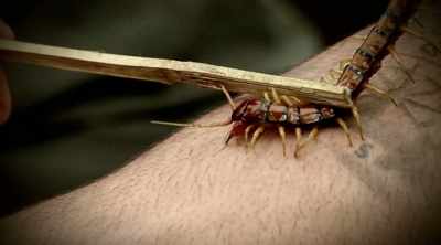 It's like someone's digging
in my arm with a rusty nail, - Kings of Pain
