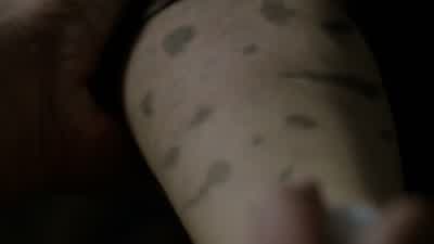 It's on her neck too. - Teen Wolf