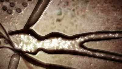 It's the job of our immune system -
an astoundingly complex network - - The Human Body: Secrets of Your Life Revealed