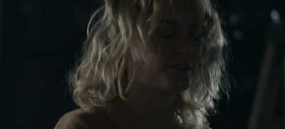 It's, um... old wounds. - Dear Edward