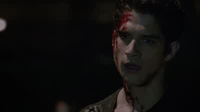 It's you. - Teen Wolf