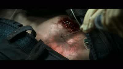 I've never seen a wound like this. - Doctor Strange
