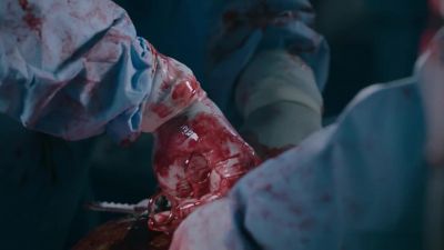 Just a few more stitches and... - The Resident