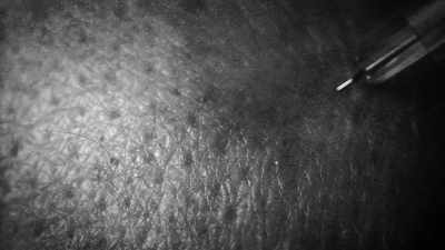 Just the prick of a needle - 35 Serial Killers the World Wants to Forget