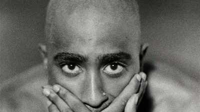 KAREN: He got alopecia. - Dear Mama