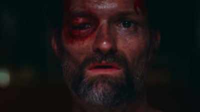 -[Laughs] - A Wounded Fawn