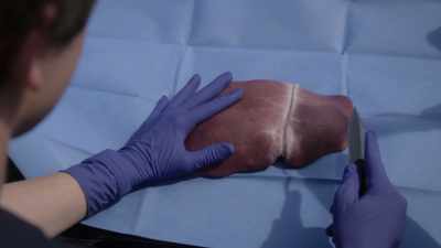 Less intrusive cut would be
along the falciform ligament - The Good Doctor