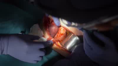 Let's get the deep Balfour in here. - The Good Doctor