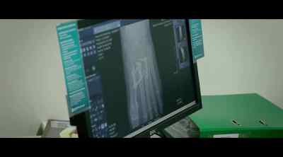 Let's have a look at your X-ray. - 100 Foot Wave
