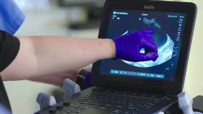 Looking at it on an ultrasound, - Secrets of the Zoo