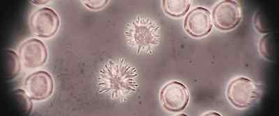 Looks like the alien cells
are somehow - The Thing