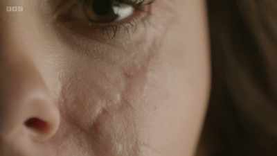 Losing just small amounts
of blood - The Human Body: Secrets of Your Life Revealed