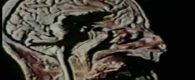 LSD: This is where I
have my effect, in the mind. - MK Ultra