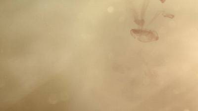 Making this film is what I need to survive - He Dreams of Giants