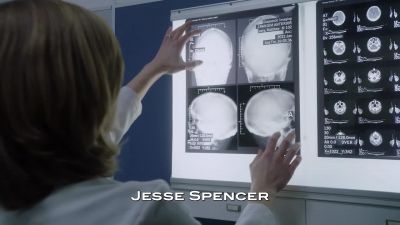 Memory loss, dizziness,
bleeding from the ear. - Chicago Fire
