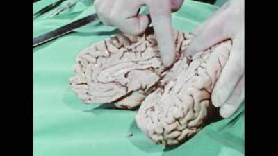 Michael Gazzaniga had said
that the right hemisphere - The Divided Brain
