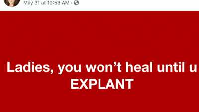 - [Michelle] And on there, - Explant