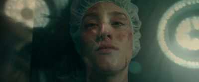 Midline sternotomy
with manubrial splitting. - Terminator: Dark Fate
