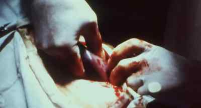 Modern technology
may someday find a solution, - Faces of Death