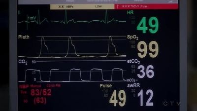 (MONITOR BEEPING RAPIDLY) - Grey's Anatomy