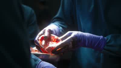 MORGAN: That'’s a large tissue defect in the left breast. - The Good Doctor