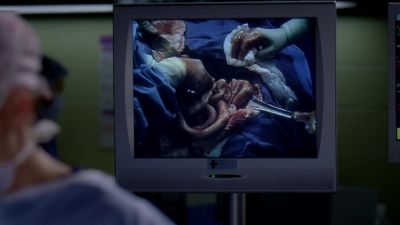 Mr. Aranda, let's get
you up to bronchoscopy. - Grey's Anatomy