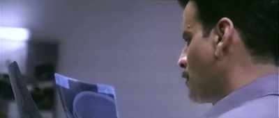 Multiple jaw surgeries.
The lower jaw has been cut. - Naam Shabana