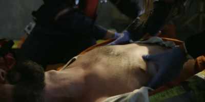 - Multiple lacerations
and contusions, - SkyMed
