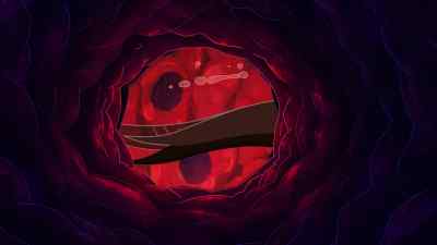 My diagnostics suggest - Big Hero 6 The Series