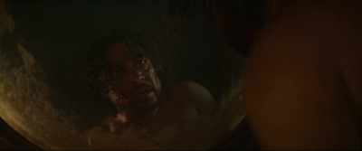 My disfigured face was
just what I needed. - Caravaggio's Shadow