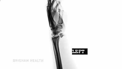My left wrist was shattered. - The Age of A.I.