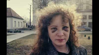 My pictures of myself battered - All the Beauty and the Bloodshed