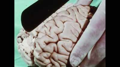 My training was that
the left hemisphere - The Divided Brain