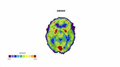 [narrator] Activity all across the brain
decreases dramatically. - The Mind, Explained