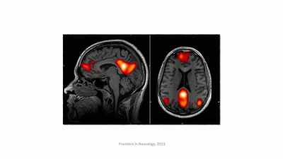 [narrator] And we can see that activity
in brain scans, - The Mind, Explained