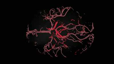 [narrator] And these roots
would've been growing all over the brain. - Explained