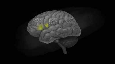 [narrator] Areas critical for speech
are right here... - Explained