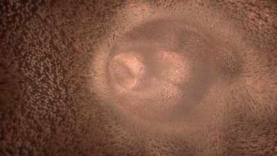 [narrator]
But when these cells malfunction… - Human: The World Within