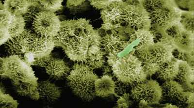 NARRATOR: The bacteria are
about the same size - Mars: One Day on the Red Planet