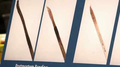 NARRATOR: The band is
a brown discoloration - Casey Anthony: An American Murder Mystery