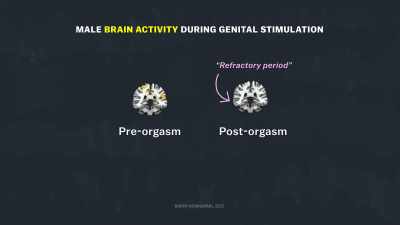 [narrator] The male brain experiences
what's called a refractory period... - Explained