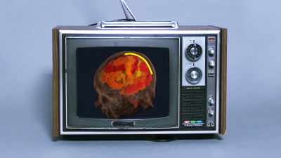 [narrator] This is your brain. - Explained