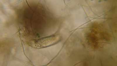 [narrator] Unseen bacteria
in the water
could prove deadly. - Mysteries of the Abandoned