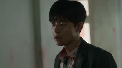 너 많이 다쳤네? - All of Us Are Dead