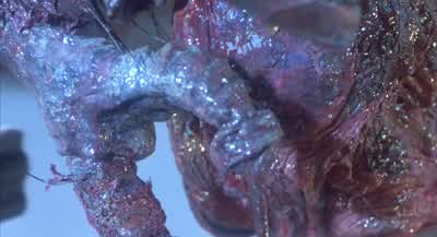 No, I can't. - The Fly